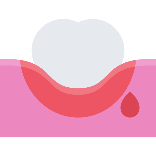 bleedinggums Svg File