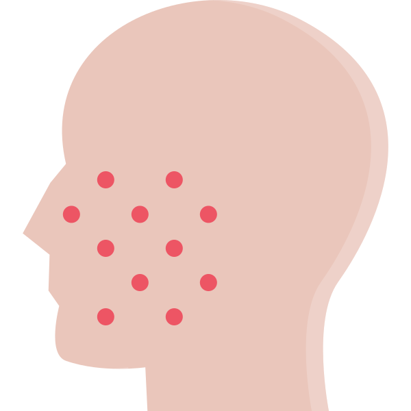 Pimples Svg File